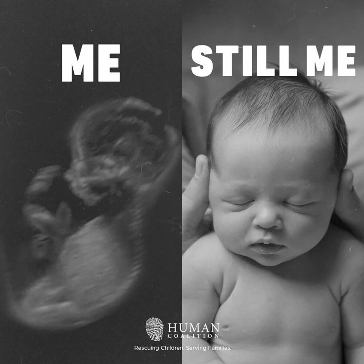 Image of a fetus with the word "ME", and an image beside it of a white infant saying "STILL ME".